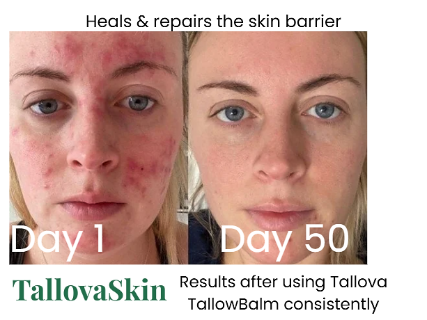 Tallova Premium Tallow Balm