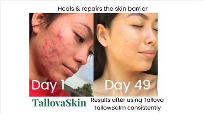 Tallova Premium Tallow Balm