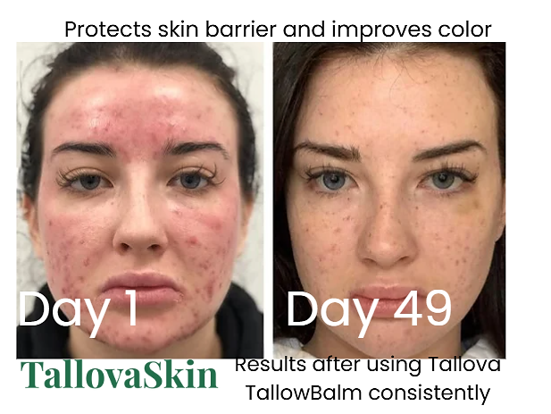 Tallova Premium Tallow Balm