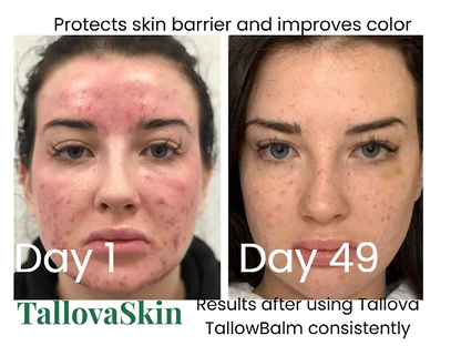 Tallova Premium Tallow Balm
